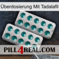 Überdosierung Mit Tadalafil dapoxetine2